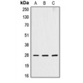 LifeSab™ Cathepsin D HC Rabbit pAb (50 µl)