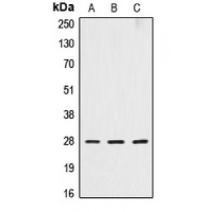 LifeSab™ Cathepsin D HC Rabbit pAb (50 µl)