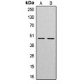 LifeSab™ Cathepsin E Rabbit pAb (50 µl)