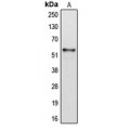 LifeSab™ Cytochrome P450 2B6 Rabbit pAb (50 µl)