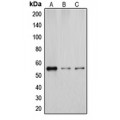 LifeSab™ Cytochrome P450 2D6 Rabbit pAb (50 µl)