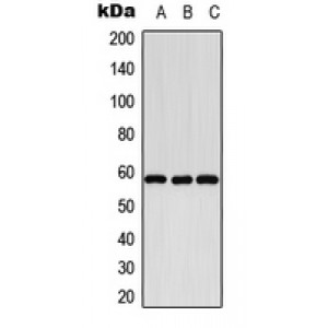 LifeSab™ Cytochrome P450 8B1 Rabbit pAb (50 µl)