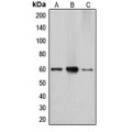 LifeSab™ Cytochrome P450 27A1 Rabbit pAb (50 µl)