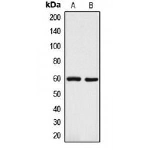 LifeSab™ TRP2 Rabbit pAb (50 µl)