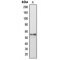 LifeSab™ DFNA5 Rabbit pAb (50 µl)