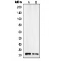 LifeSab™ DSCR1 Rabbit pAb (50 µl)