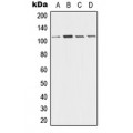 LifeSab™ Desmoglein 3 Rabbit pAb (50 µl)