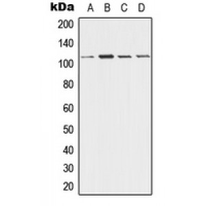 LifeSab™ Desmoglein 3 Rabbit pAb (50 µl)