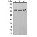 LifeSab™ ERCC4 Rabbit pAb (50 µl)