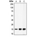 LifeSab™ Factor II APII Rabbit pAb (50 µl)