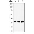 LifeSab™ Factor X HC Rabbit pAb (50 µl)