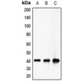 LifeSab™ Factor XII HC Rabbit pAb (50 µl)