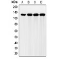 LifeSab™ FGFR2 Rabbit pAb (50 µl)