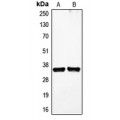 LifeSab™ VEGFD Rabbit pAb (50 µl)