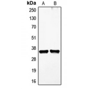 LifeSab™ VEGFD Rabbit pAb (50 µl)