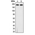 LifeSab™ VEGFR1 (pY1213) Rabbit pAb (50 µl)