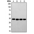 LifeSab™ FR alpha Rabbit pAb (50 µl)