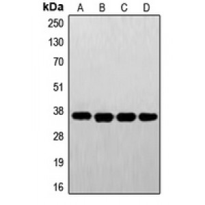 LifeSab™ FR alpha Rabbit pAb (50 µl)