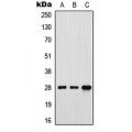 LifeSab™ FR gamma Rabbit pAb (50 µl)