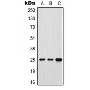 LifeSab™ FR gamma Rabbit pAb (50 µl)