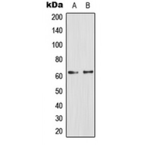 LifeSab™ Glucagon Receptor Rabbit pAb (50 µl)