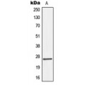 LifeSab™ Connexin 26 Rabbit pAb (50 µl)