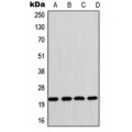 LifeSab™ CD42c Rabbit pAb (50 µl)