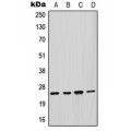 LifeSab™ GSTM2 Rabbit pAb (50 µl)