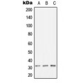 LifeSab™ HLA-DOB Rabbit pAb (50 µl)