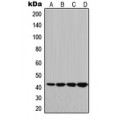 LifeSab™ HLA-G Rabbit pAb (50 µl)