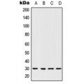 LifeSab™ HOXC12 Rabbit pAb (50 µl)