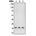 LifeSab™ NRAS/HRAS/KRAS Rabbit pAb (50 µl)