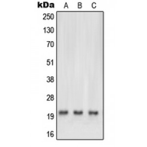 LifeSab™ NRAS/HRAS/KRAS Rabbit pAb (50 µl)