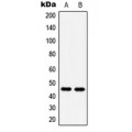 LifeSab™ 5-HT1A Rabbit pAb (50 µl)