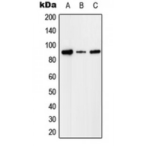 LifeSab™ Factor I Rabbit pAb (50 µl)