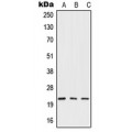 LifeSab™ IFN beta Rabbit pAb (50 µl)