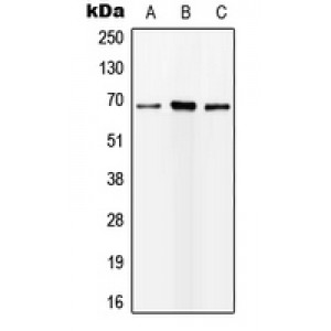 LifeSab™ ALS Rabbit pAb (50 µl)