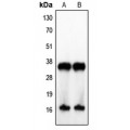 LifeSab™ IL-4 Rabbit pAb (50 µl)