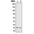 LifeSab™ IL-5 Rabbit pAb (50 µl)