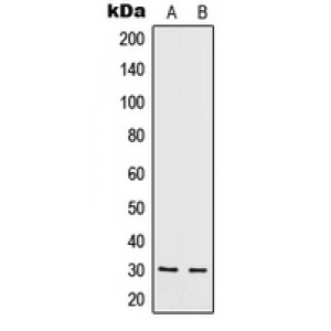 LifeSab™ IL-5 Rabbit pAb (50 µl)