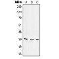 LifeSab™ CD49f LC Rabbit pAb (50 µl)