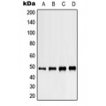 LifeSab™ Kir3.4 Rabbit pAb (50 µl)