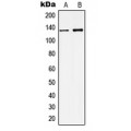 LifeSab™ KCNMA1 Rabbit pAb (50 µl)