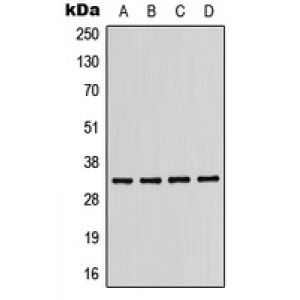 LifeSab™ CD158b1 Rabbit pAb (50 µl)