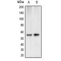 LifeSab™ Cytokeratin 7 Rabbit pAb (50 µl)