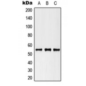 LifeSab™ Cytokeratin 8 (pS73) Rabbit pAb (50 µl)