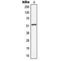 LifeSab™ Cytokeratin 13 Rabbit pAb (50 µl)