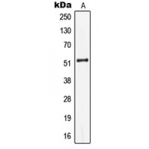 LifeSab™ Cytokeratin 13 Rabbit pAb (50 µl)