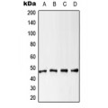 LifeSab™ Cytokeratin 18 (pS52) Rabbit pAb (50 µl)