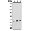 LifeSab™ Cytokeratin 18 Rabbit pAb (50 µl)